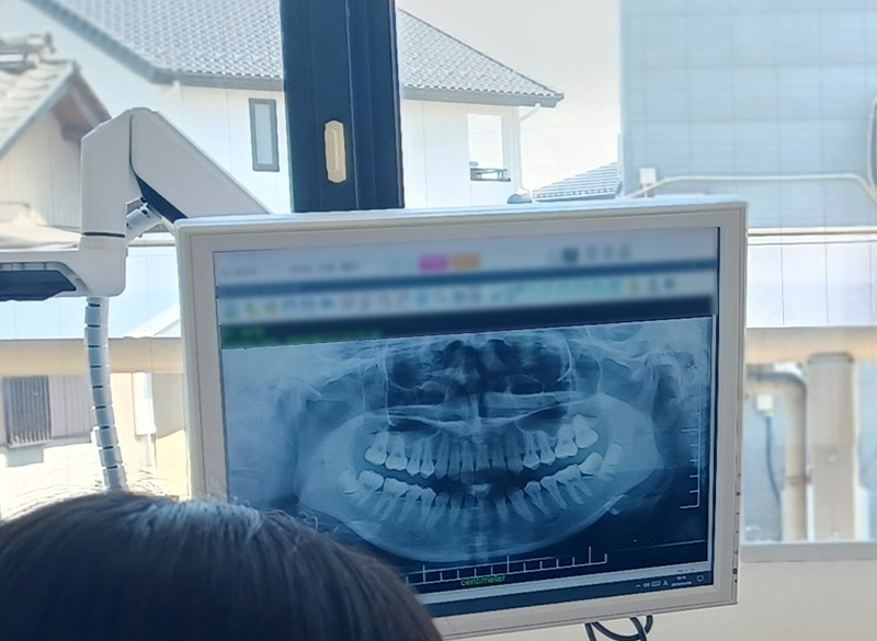 説明用モニター