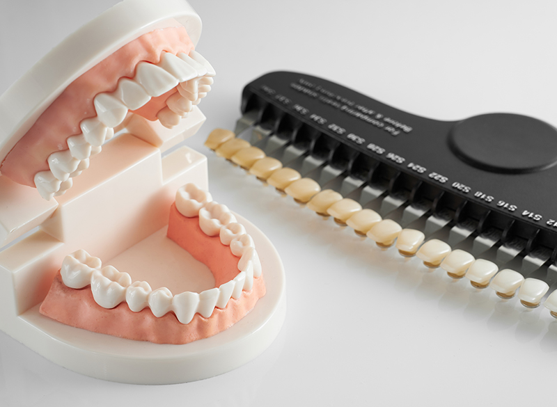 ホワイトニング